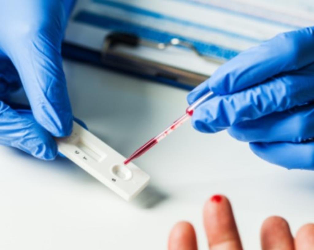 Como Interpretar Un Test Serologico Científicos mexicanos crean prueba serológica para detectar COVID-19